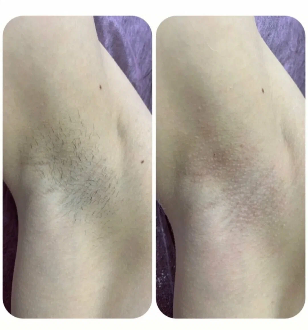 Результат до и после